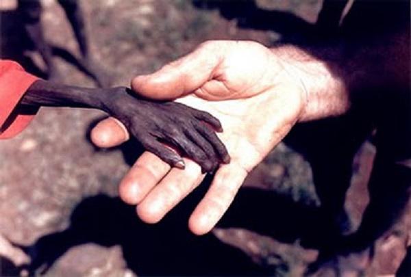 1980 Uganda Famine photographs that shook the world